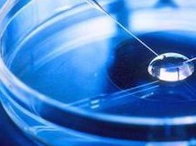 torch一定要检查吗  Torch检查前注意事项