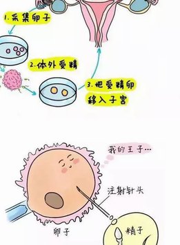 2026重庆试管费用大揭秘，一二三代详细清单一次看清！