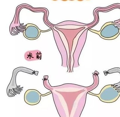 2026年广东十大试管婴儿医院排名？附医院详细费用！